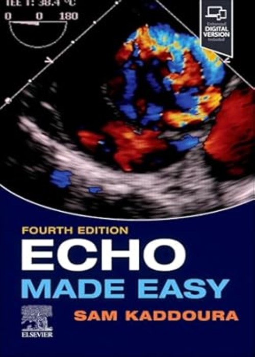 Echo Made Easy: 4ed