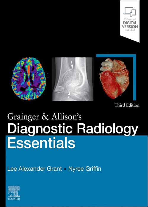 Grainger & Allison's Diagnostic Radiology Essentials, 3/e