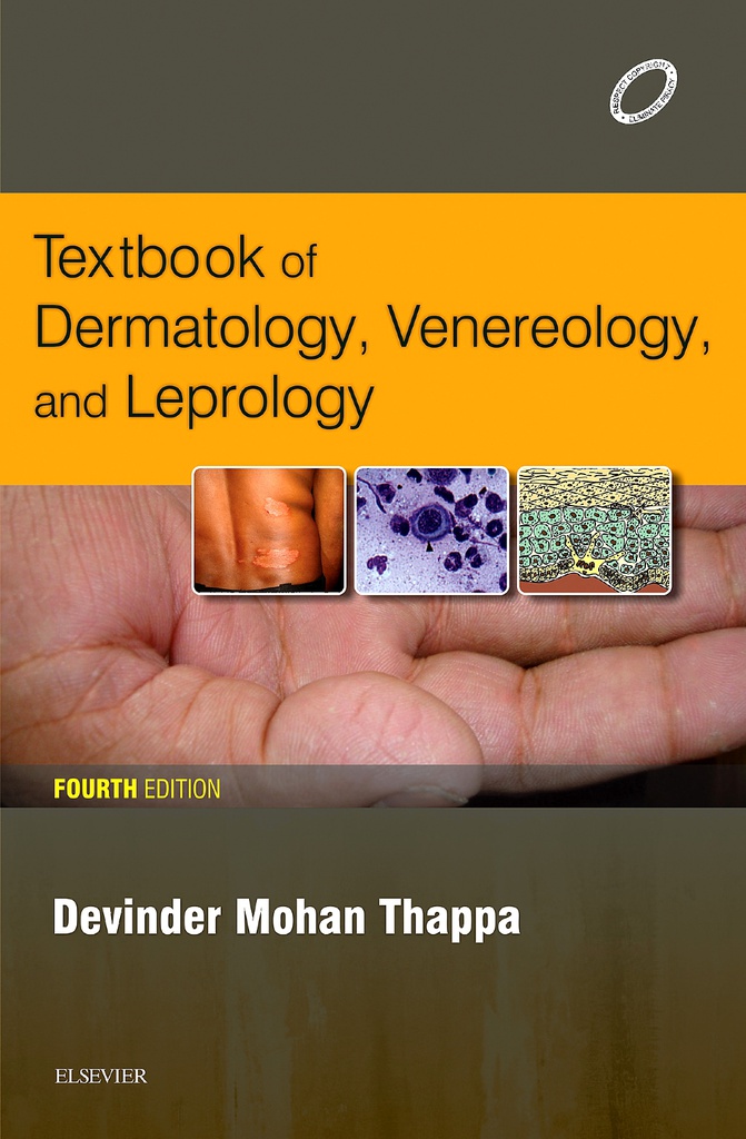 Textbook of Dermatology, Venereology and Leprology, 4/e