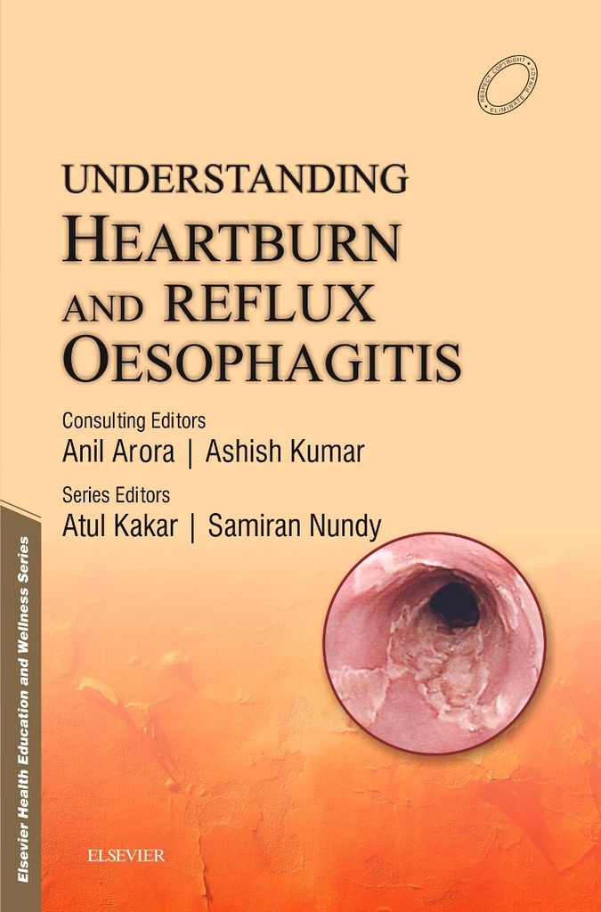 Understanding Heartburn and Reflux Oesophagitis, 1/e