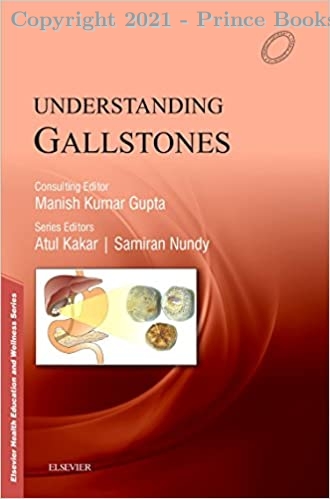 Understanding Gallstones, 1/e