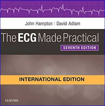 The ECG Made Practical, IE, 7e