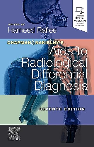 Chapman and Nakielny's Aids to Radiological Differential Diagnosis, 7/e