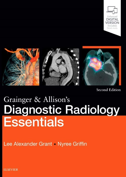 Grainger and Allison's Diagnostic Radiology Essentials: Expert Consult: Online and Print, 2/e