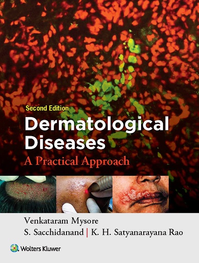 [B9789351295464] Dermatological Diseases: A Practical Approach, 2/e