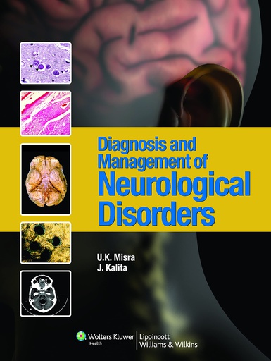 [B9788184731910] Diagnosis and Management of Neurological Disorders