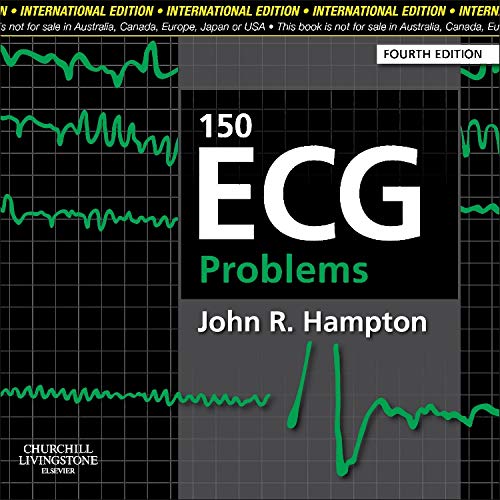 [B9780702046711] 150 ECG Problems, IE, 4/e