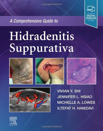 [B9780323777247] A Comprehensive Guide to Hidradenitis Suppurativa: 1ed