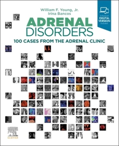 [B9780323792851] Adrenal Disorders: 100 Cases from the Adrenal Clinic 1ed