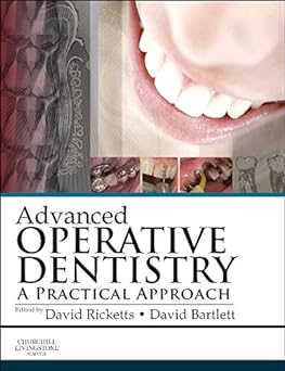 [B9780702055386] Advanced Operative Dentistry: A Practical Approach 1ed