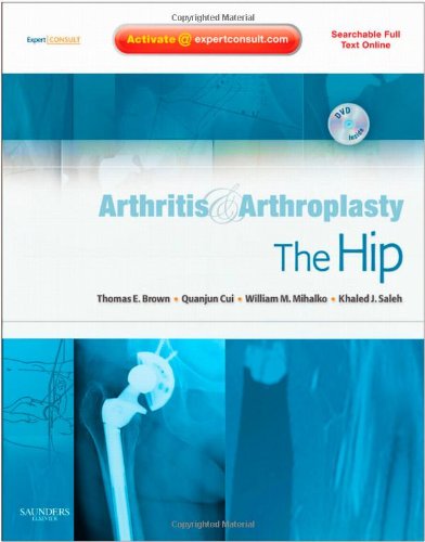 [B9781416049739] Arthritis and Arthroplasty: The Hip: Expert Consult - Online, Print and DVD 1ed