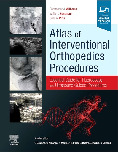 [B9780323755146] Atlas of Interventional Orthopedics Procedures: Essential Guide for Fluoroscopy and Ultrasound Guided Procedures 1ed