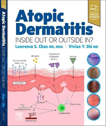 [B9780323847445] Atopic Dermatitis: Inside Out or Outside In: 1ed