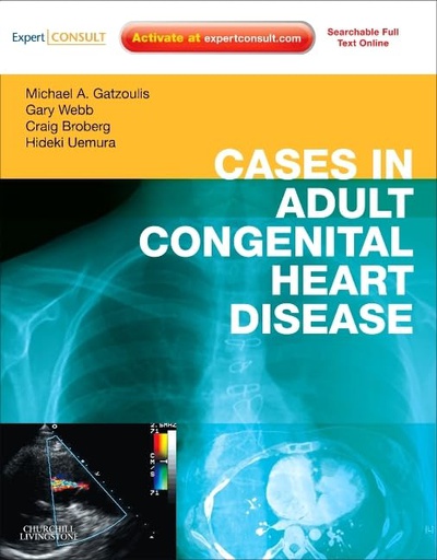 [B9780443067129] Cases in Adult Congenital Heart Disease - Expert Consult: Online and Print: Atlas 1ed