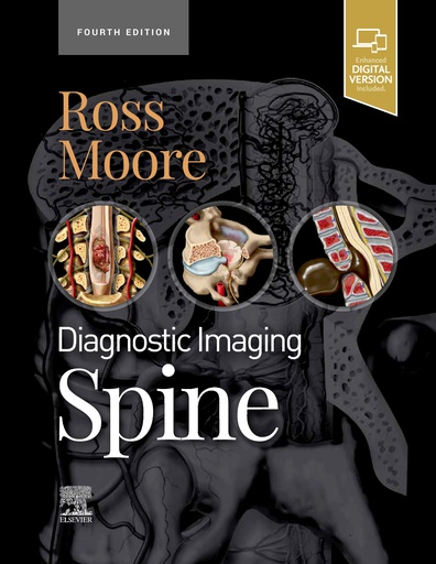 [B9780323793995] Diagnostic Imaging: Spine:4ed 