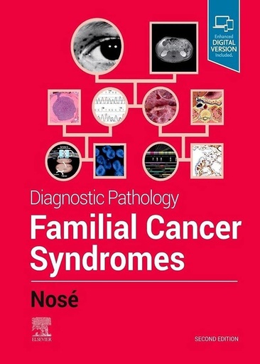 [B9780323712040] Diagnostic Pathology: Familial Cancer Syndromes: 2ed