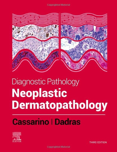 [B9780323798266] Diagnostic Pathology: Neoplastic Dermatopathology, 3/e