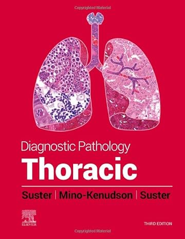 [B9780323834766] Diagnostic Pathology: Thoracic: 3ed