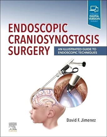 [B9780323721752] Endoscopic Craniosynostosis Surgery: An Illustrated Guide to Endoscopic Techniques 1ed