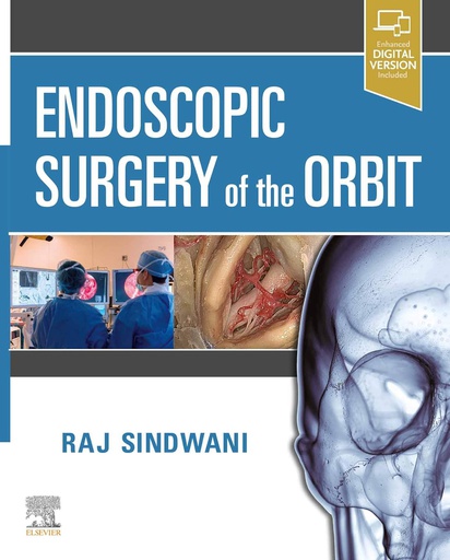 [B9780323613293] Endoscopic Surgery of the Orbit: 1ed