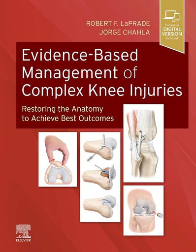 [B9780323713108] Evidence-Based Management of Complex Knee Injuries: Restoring the Anatomy to Achieve Best Outcomes 1ed