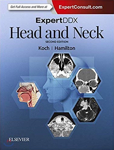 [B9780323554053] ExpertDDX: Head and Neck: 2ed