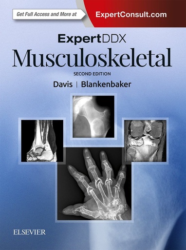 [B9780323524834] ExpertDDx: Musculoskeletal: 2ed