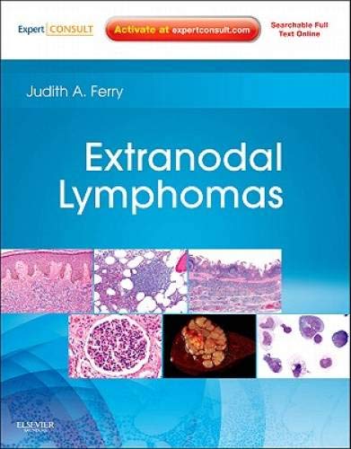 [B9781416045793] Extranodal Lymphomas: Expert Consult - Online and Print 1ed