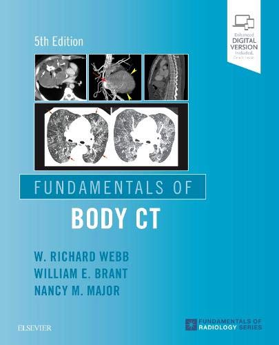 [B9780323608329] Fundamentals of Body CT: 5ed