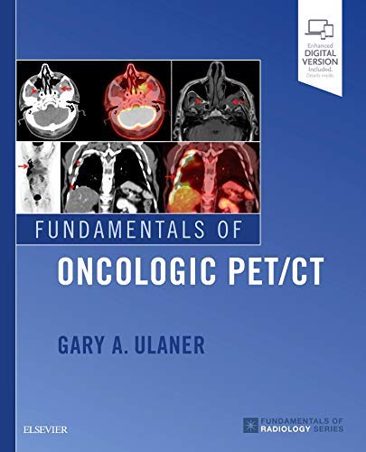 [B9780323568692] Fundamentals of Oncologic PET/CT: 1ed