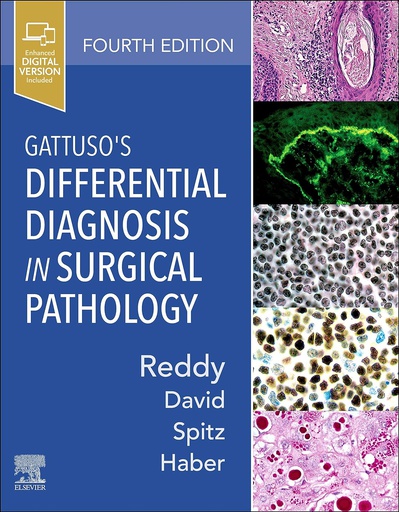 [B9780323661652] Gattuso's Differential Diagnosis in Surgical Pathology: 4ed