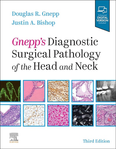 [B9780323531146] Gnepp's Diagnostic Surgical Pathology of the Head and Neck: 3ed