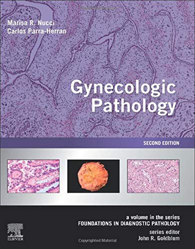 [B9780323359092] Gynecologic Pathology: A VOL in Foundations in Diagnostic Pathology Series 2ed