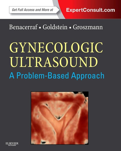 [B9781437737943] Gynecologic Ultrasound: A Problem-Based Approach: 1ed