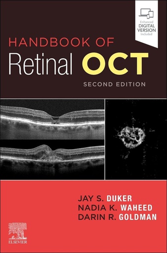 [B9780323757720] Handbook of Retinal OCT: Optical Coherence Tomography: 2ed