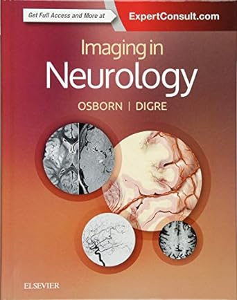 [B9780323447812] Imaging in Neurology: 1ed