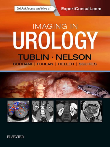 [B9780323548090] Imaging in Urology: 1ed