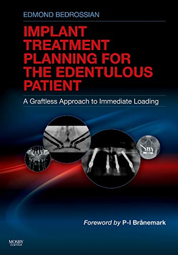 [B9780323073684] Implant Treatment Planning for the Edentulous Patient: A Graftless Approach to Immediate Loading 1ed