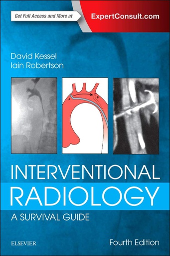 [B9780702067303] Interventional Radiology: A Survival Guide: 4ed