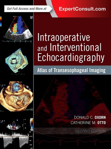 [B9780323358255] Intraoperative and Interventional Echocardiography: Atlas of Transesophageal Imaging 2ed