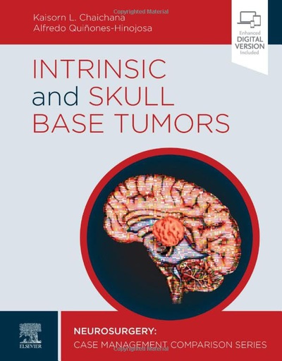 [B9780323696425] Intrinsic and Skull Base Tumors: Neurosurgery: Case Management Comparison Series 1ed