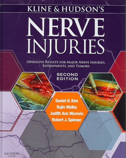 [B9780721695372] Kline and Hudson's Nerve Injuries: Operative Results for Major Nerve Injuries, Entrapments and Tumors 2ed