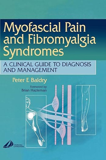 [B9780443070037] Myofascial Pain and Fibromyalgia Syndromes: A Clinical Guide to Diagnosis and Management 1ed