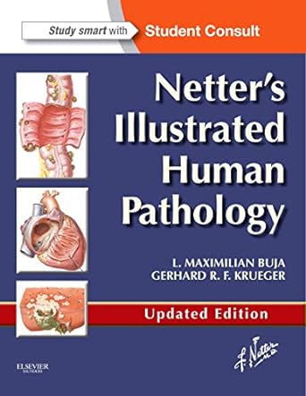 [B9780323220897] Netter's Illustrated Human Pathology Updated Edition: with Student Consult Access 1ed