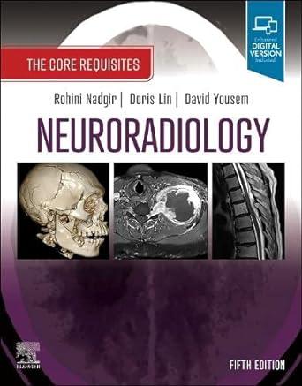 [B9780323759755] Neuroradiology: The Core Requisites 5ed