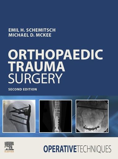 [B9780323508889] Operative Techniques: Orthopaedic Trauma Surgery: 2ed