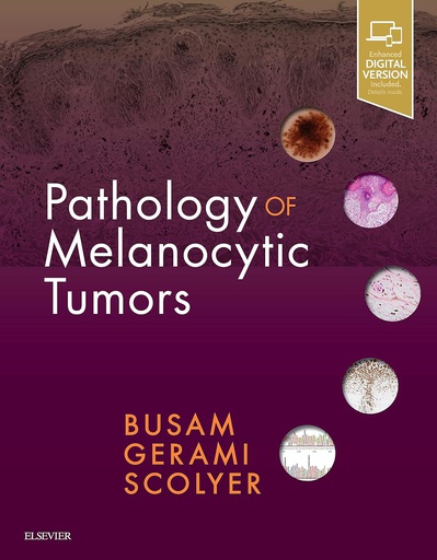 [B9780323374576] Pathology of Melanocytic Tumors: 1ed