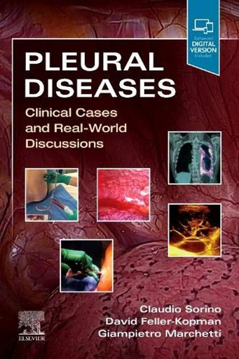 [B9780323795418] Pleural Diseases: Clinical Cases and Real-World Discussions 1ed