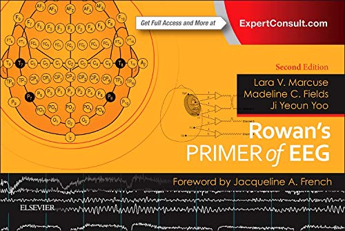 [B9780323353878] Rowan's Primer of EEG: 2ed