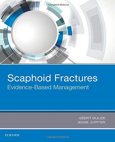 [B9780323485647] Scaphoid Fractures: Evidence-Based Management 1ed